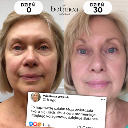 Nocna Maseczka Kolagenowa z Kwasem Kojowym Botanea™